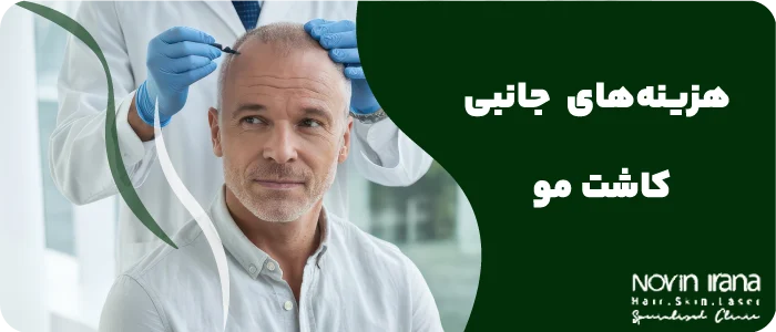 قیمت کاشت مو در ایران